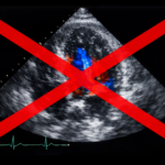 Opname Jeroen Bosch Ziekenhuis